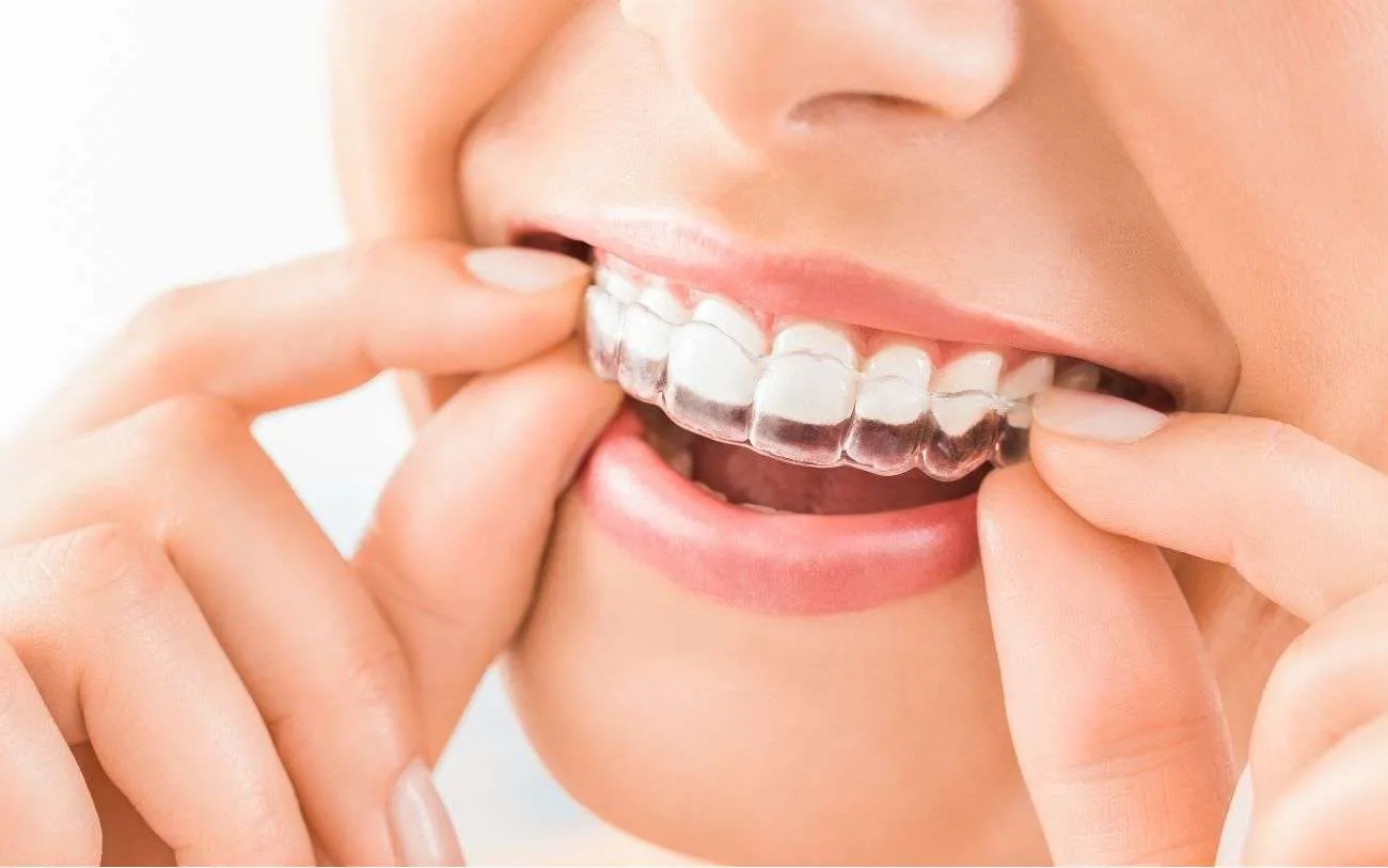 Your Guide to Finding the Best Dental Clinic in Chennai