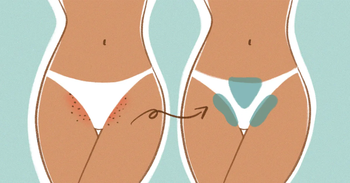 Vajacial Near Me – Rejuvenating Treatments for Intimate Skincare